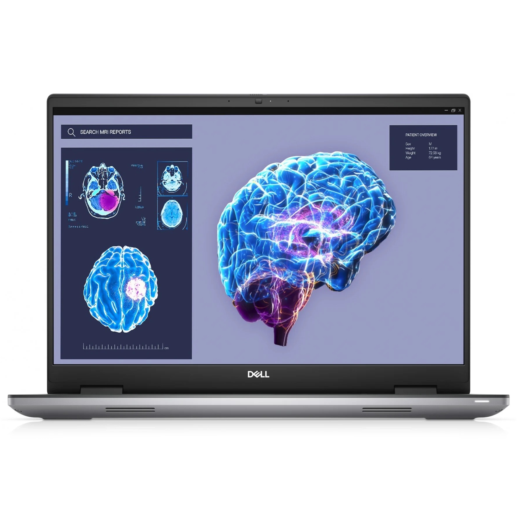 Dell Precision 7680 16" FHD+ i9-13950HX 64GB 1TB RTX 5000 ADA 16GB A-Klass